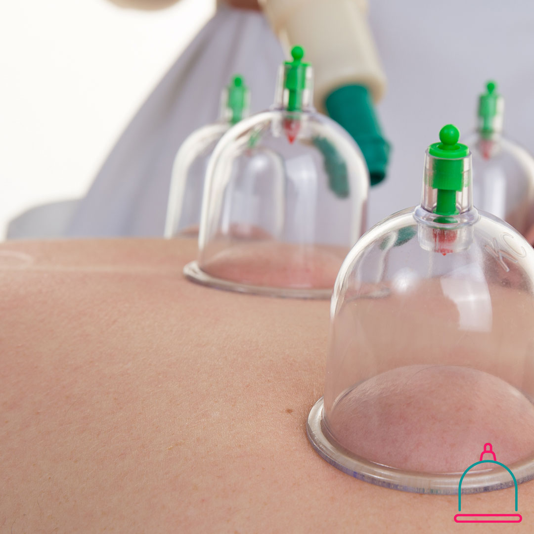 Wat-is-Hijama-therapie