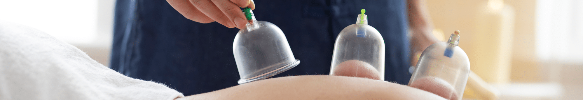Goedkope hijama cups