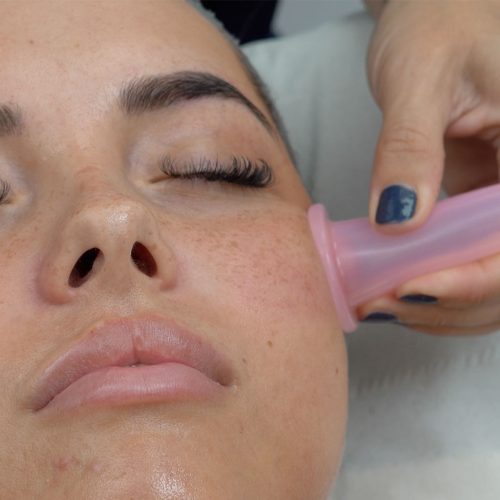 Facial cupping set 5 stuks